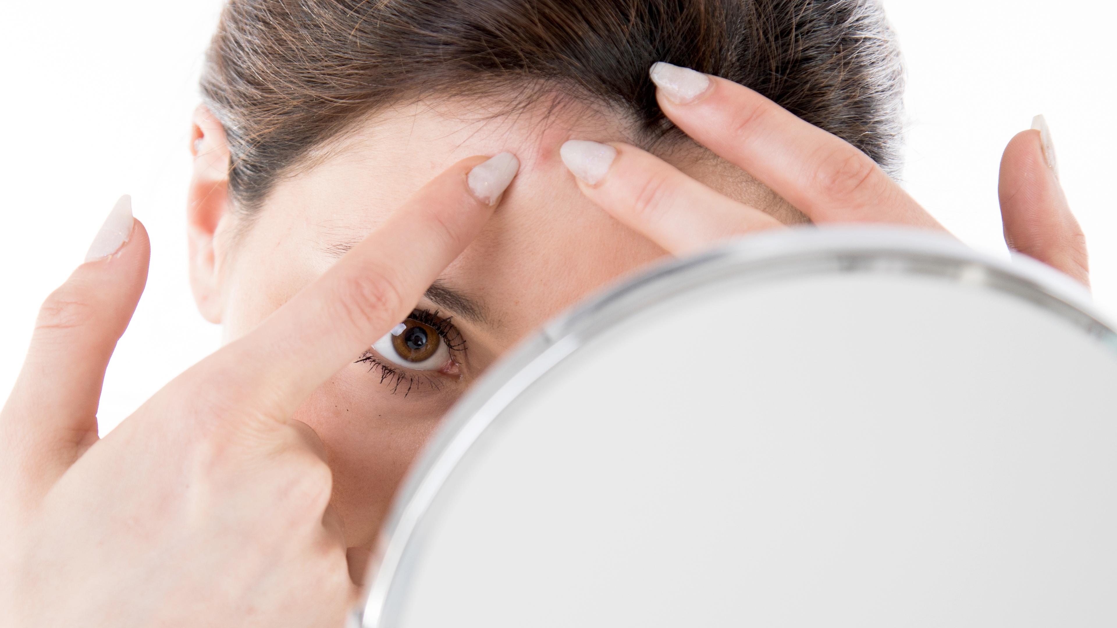 Eine Frau drückt sich vor dem Spiegel einen Pickel an der Stirn aus.