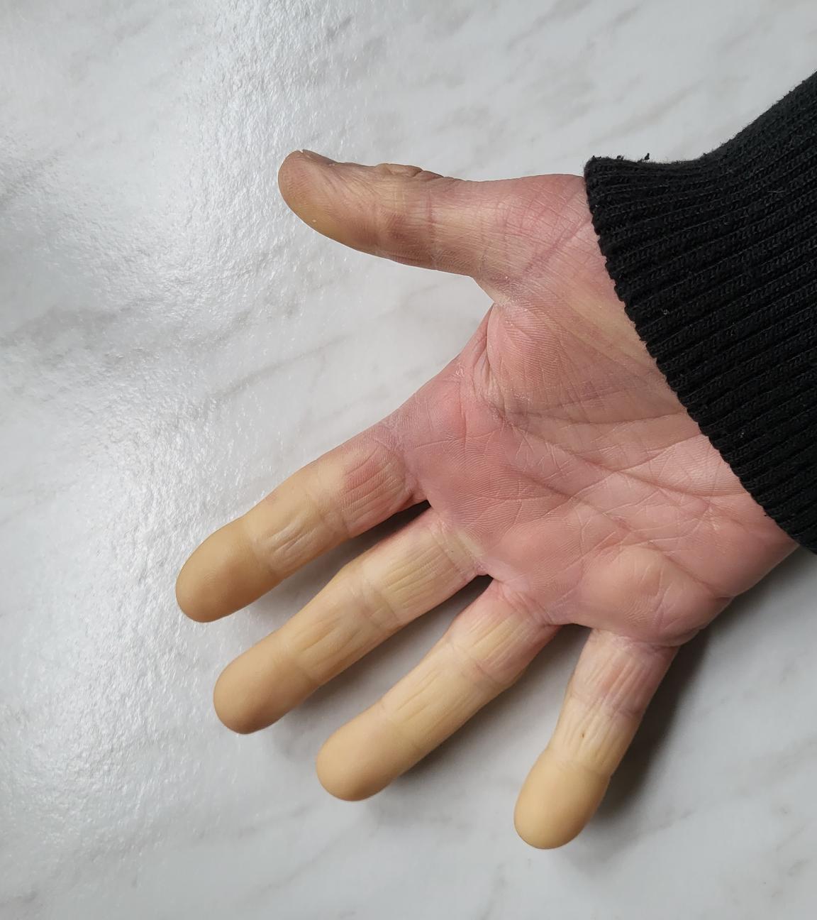 Handfläche mit weißen Fingern