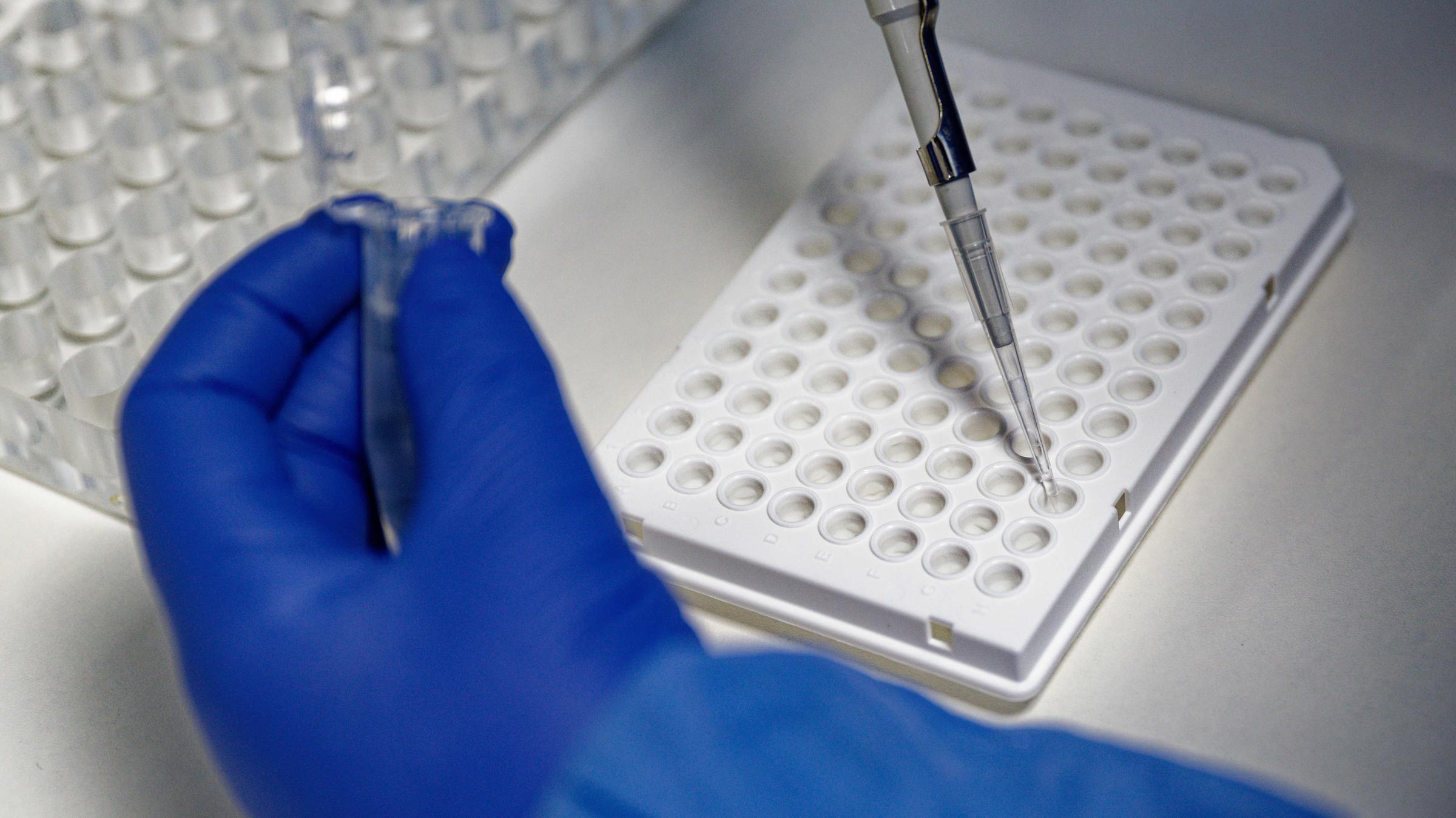 Eine Mitarbeiterin eines Labors  bereitet einen PCR-Test zur Auswertung vor.