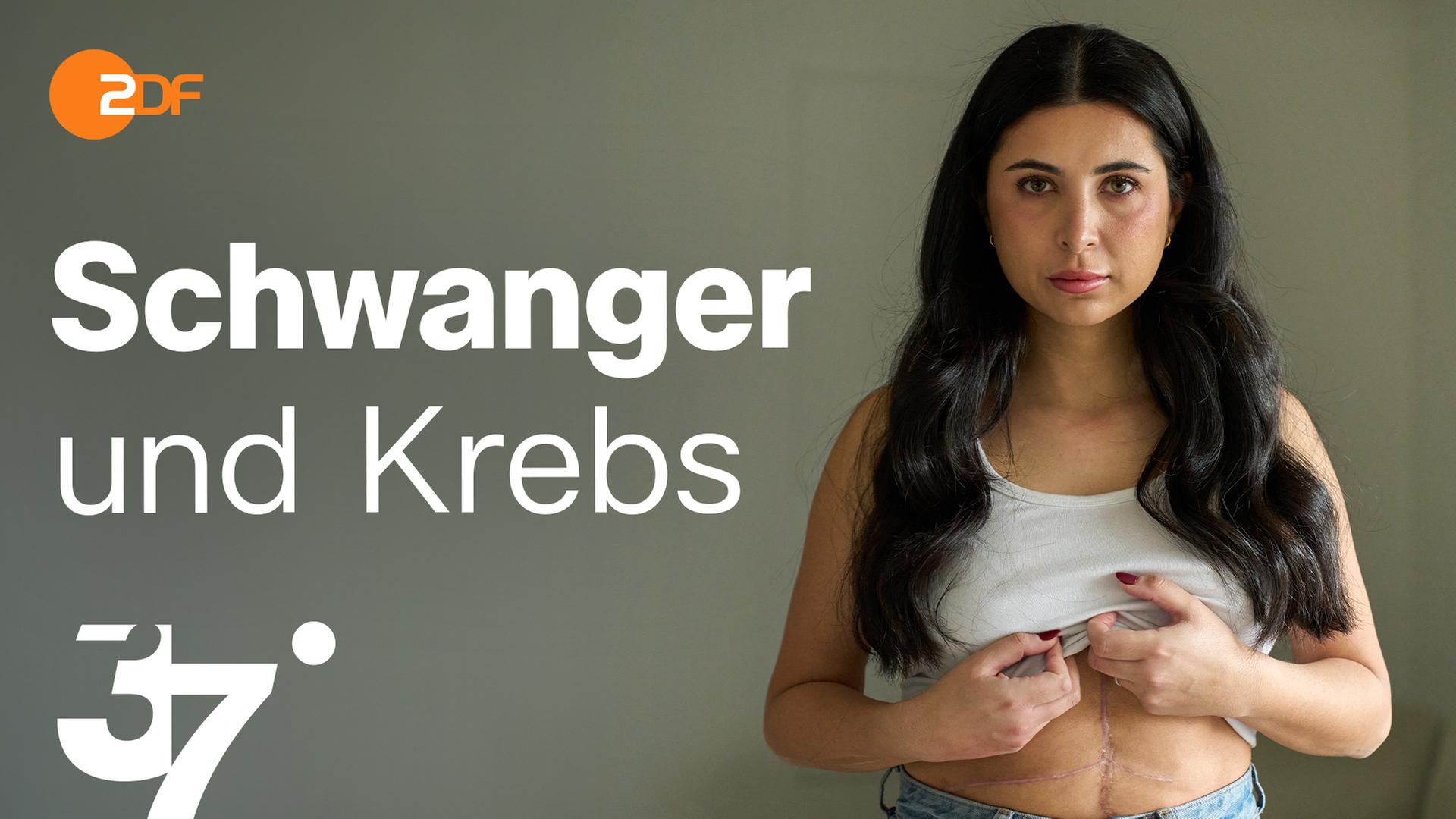 Sarah trägt ein weißes Trägertop, welches sie mit beiden Händen hochhält. Man sieht eine große Narbe über ihren Bauch. Sie schaut in die Kamera. 