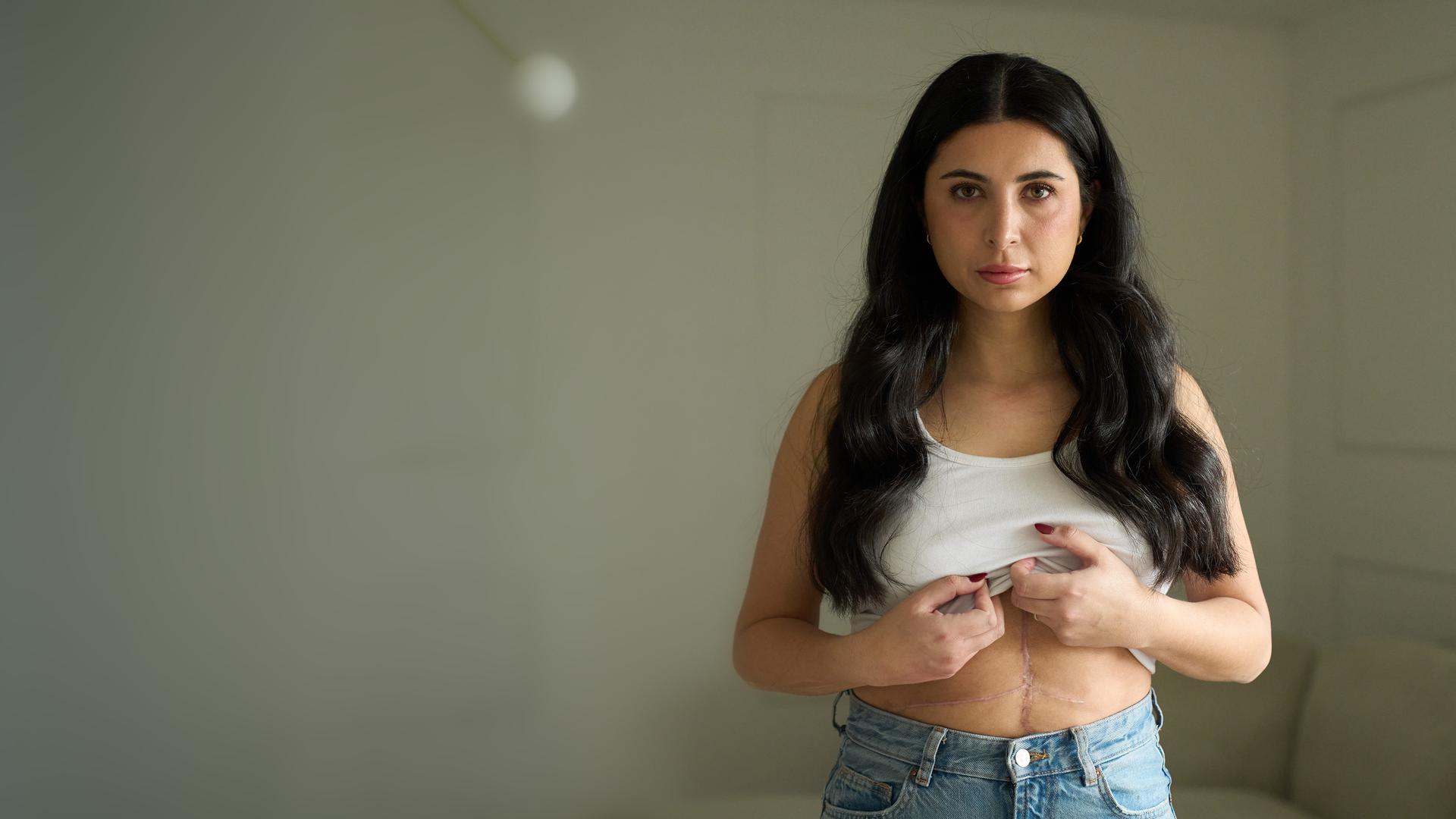 Sarah trägt ein weißes Trägertop, welches sie mit beiden Händen hochhält. Man sieht eine große Narbe über ihren Bauch. Sie schaut in die Kamera. 