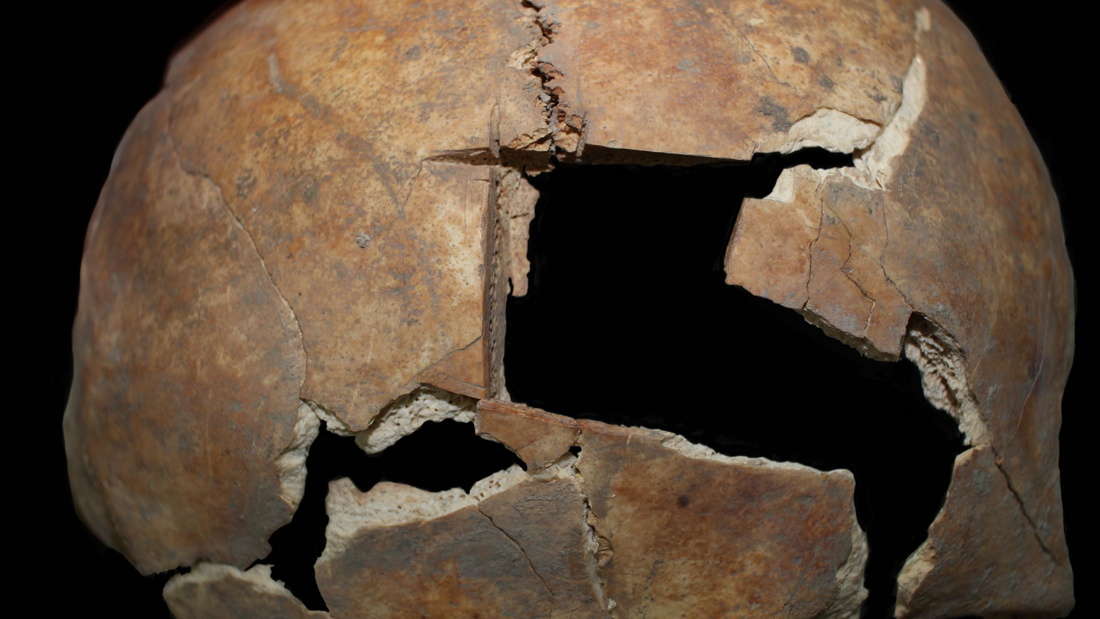 Viereckiges Loch in 3.500 Jahre altem Schädel: Forscher gehen von bronzezeitlicher OP aus