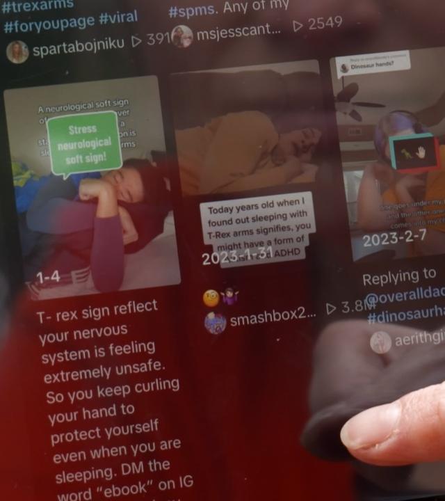 Ein Finger scrollt über einen Bildschirm mit TikTok Videos zu T-Rex-Armen als ungesunde Schlafposition.