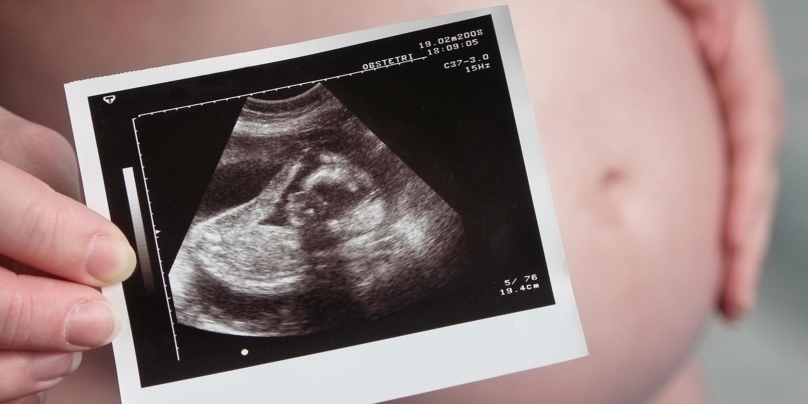 Im Hintergrund sieht man einen Schwangerschaftsbauch, welcher durch ein Ultraschallbild verdeckt wird.