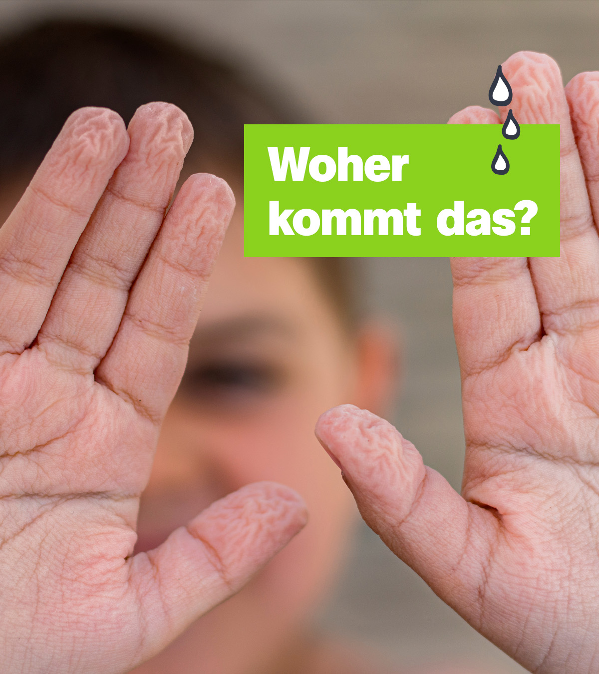 Eine Person hält ihre durch den langen Kontakt mit Wasser schrumpeligen Handflächen in die Kamera. Rechts mittig der Text "Woher kommt das?"