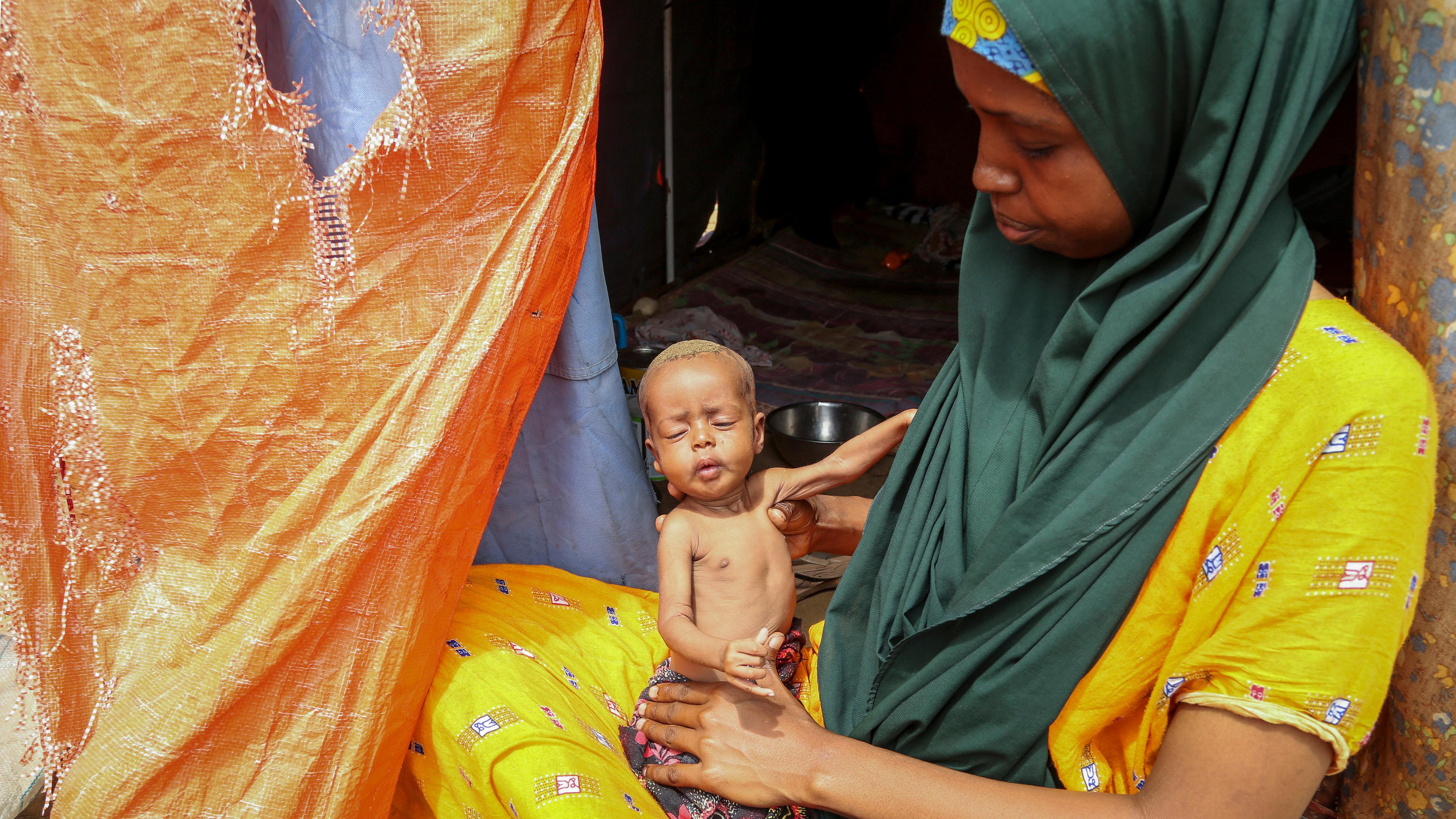 Amina Shuto, hält ihr zwei Monate altes, unterernährtes Kind in einem behelfsmäßigen Lager in Mogadischu (Somalia)