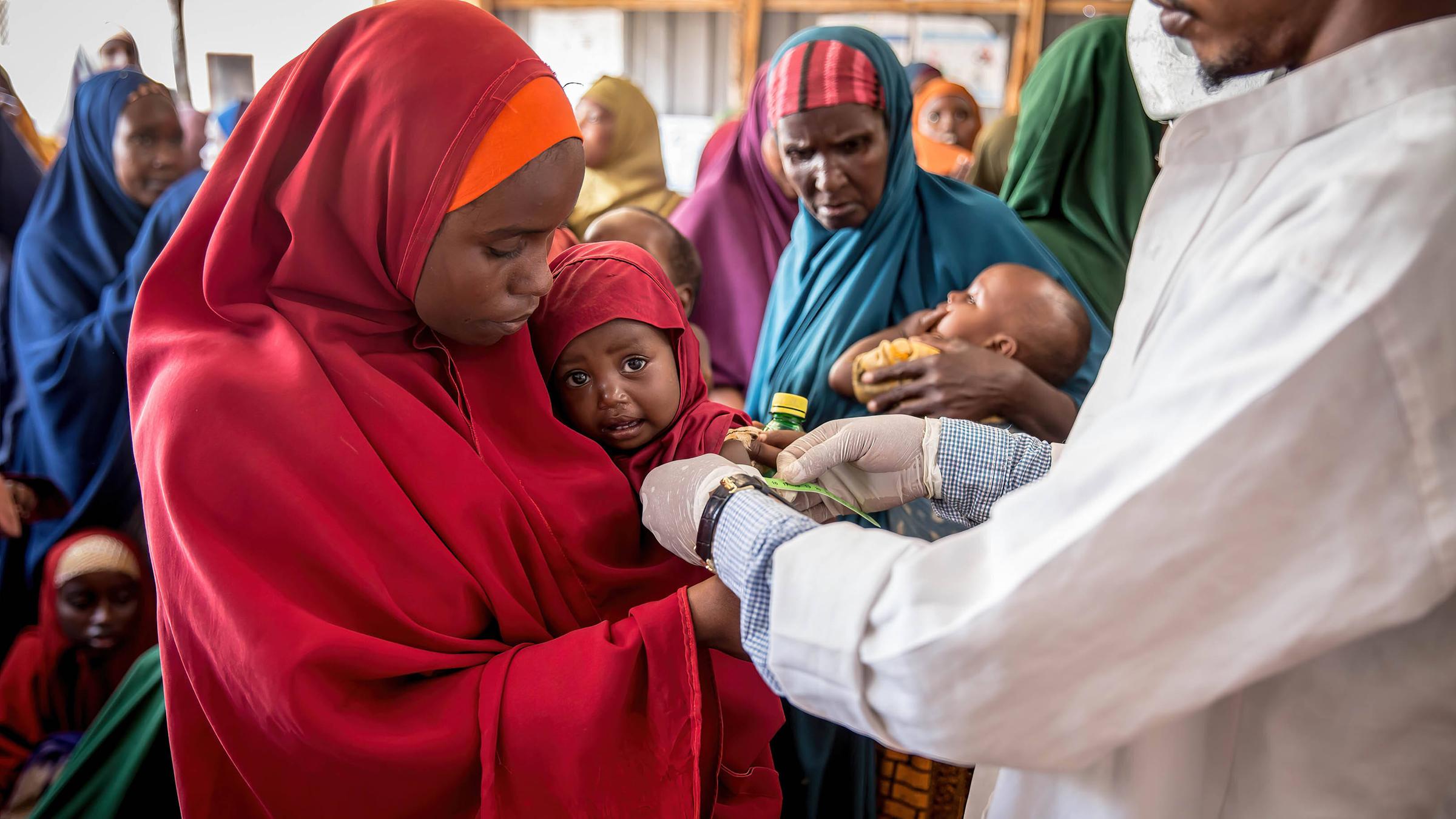 Ein Kind wird in einer Gesundheitsklinik in Baidoa auf Unterernährung untersucht.