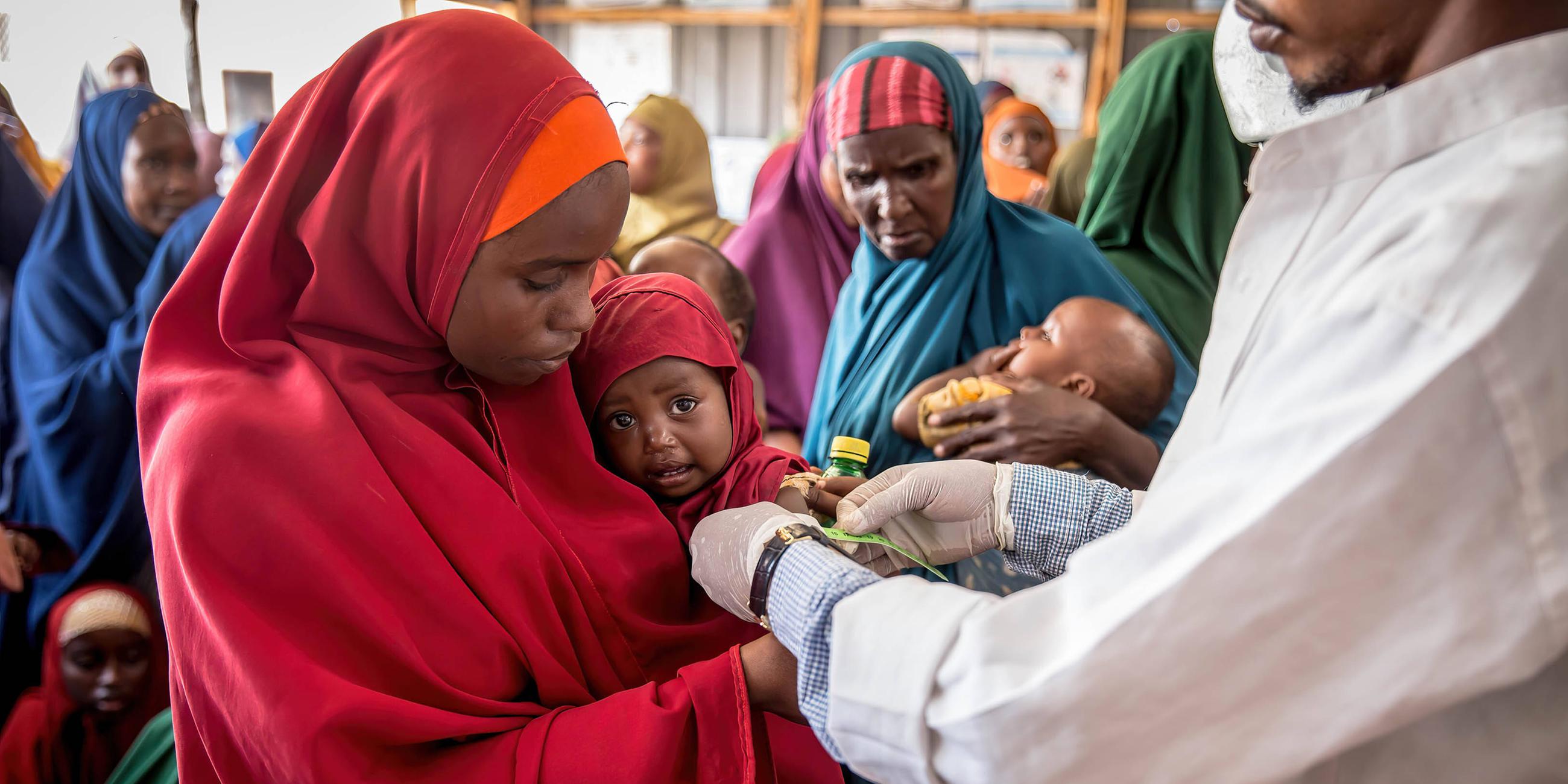 Ein Kind wird in einer Gesundheitsklinik in Baidoa auf Unterernährung untersucht.