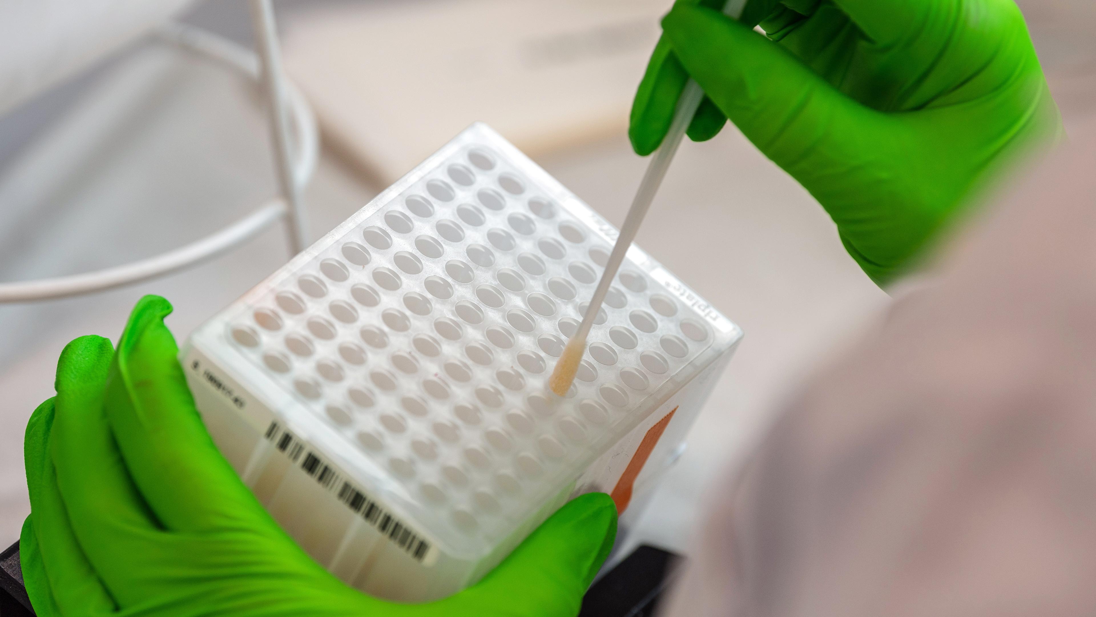 Eine mitarbeiterin im DKMS Life Science Lab arbeitet an der Einsortierung der medizinischen Wattestaebchen mit Zellen  für den Typisierungsprozess der DNA