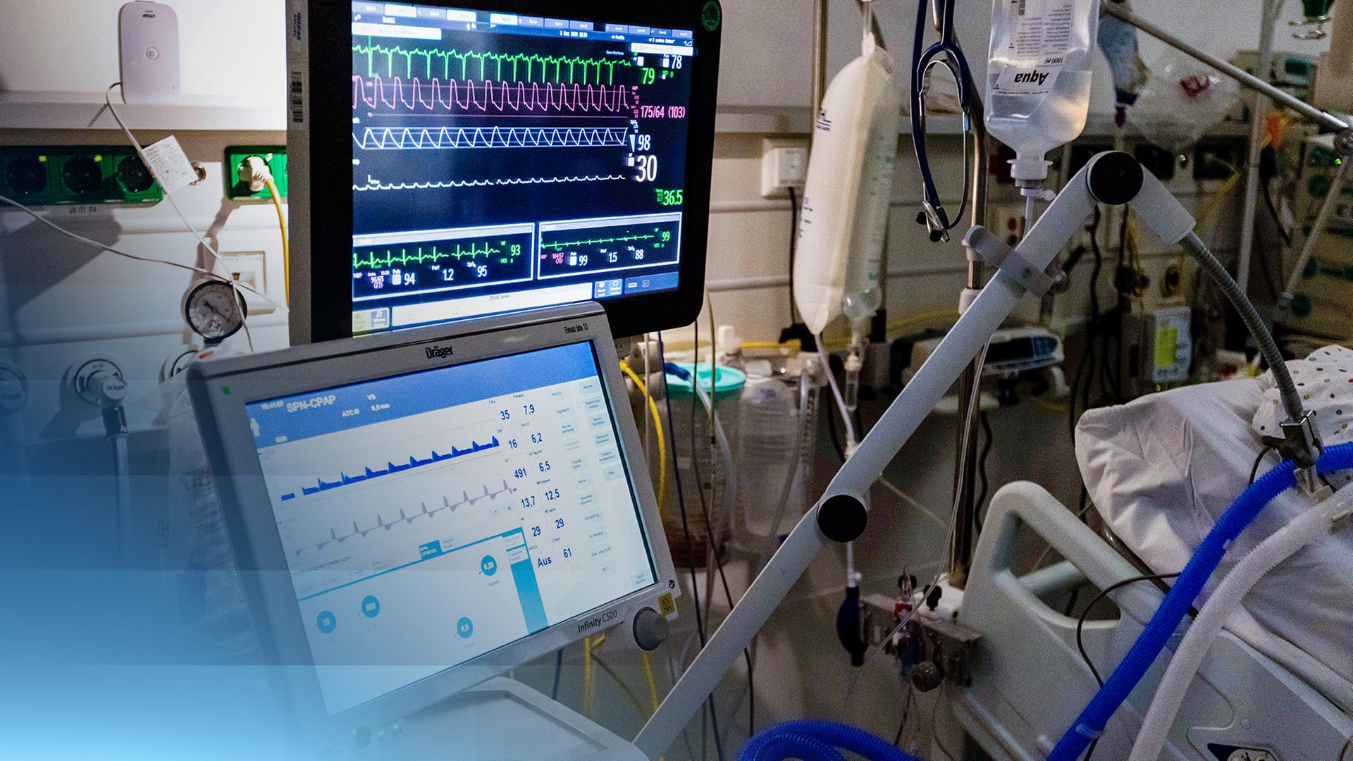 Mehrere Schläuche, Infusionsbeutel und zwei Monitore sind neben einem Krankenbett angebracht.