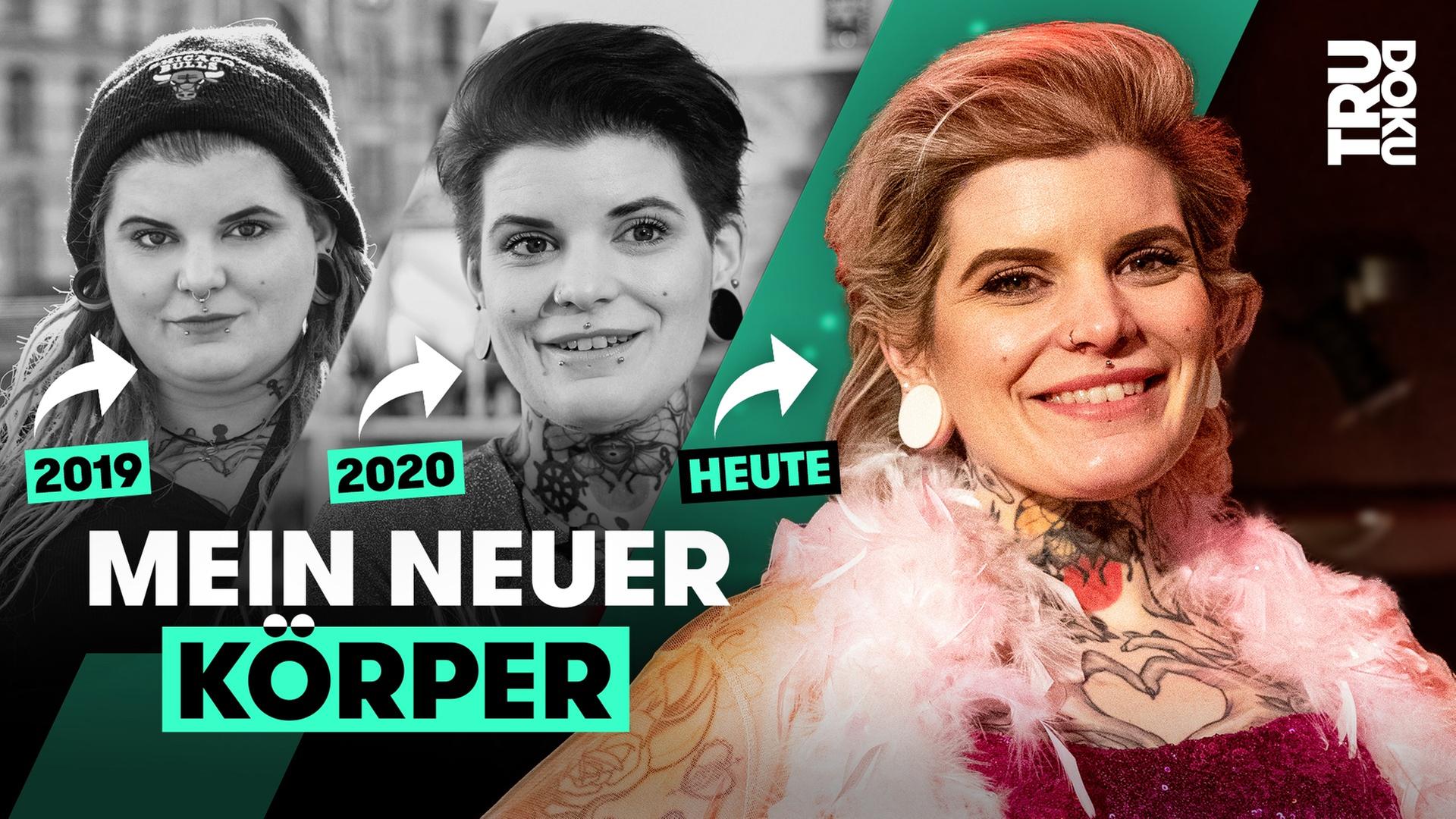 75 Kilo weniger: Miriams Leben nach der Magenverkleinerung I TRU DOKU