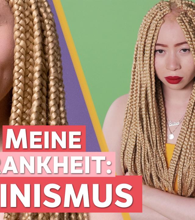 Albinismus – Ich bin eine Schwarze Frau mit Weißer Haut. - Auf Klo