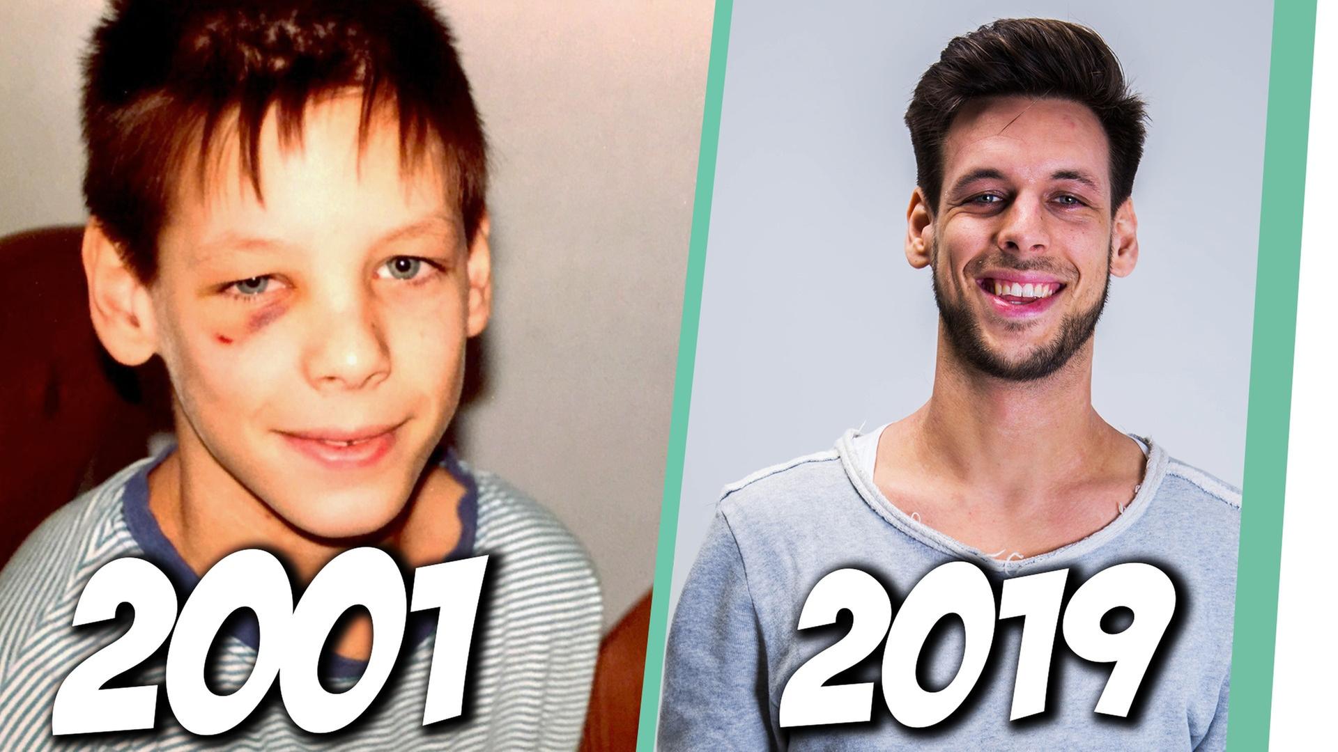 Alman Evolution - Marcel zeigt alte Kinderfotos