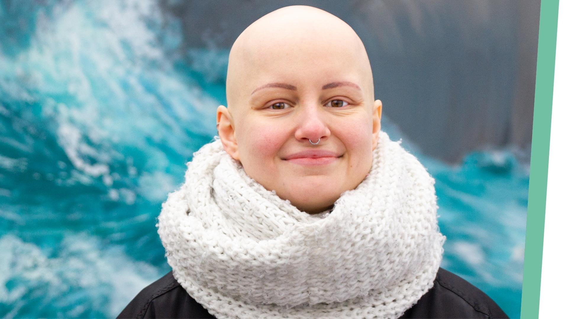 Alopecia: “Warum ich KEINE Haare mehr habe.” - Auf Klo