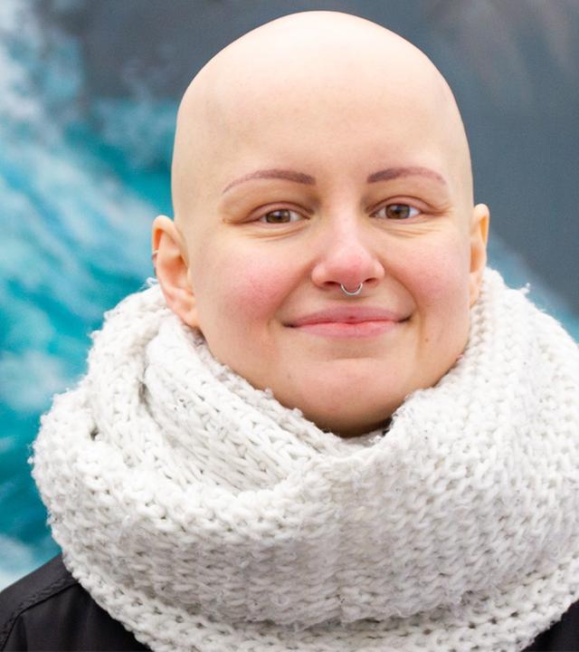 Alopecia: “Warum ich KEINE Haare mehr habe.” - Auf Klo