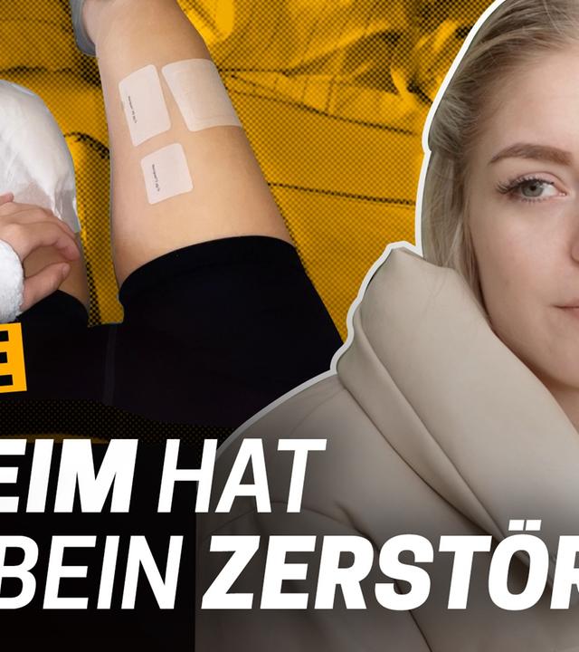 Amputation: 33 Operationen konnten mein Bein nicht retten