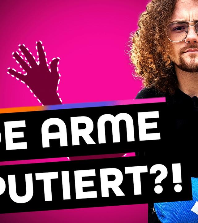Amputation: Ich will lieber ohne Arme leben!