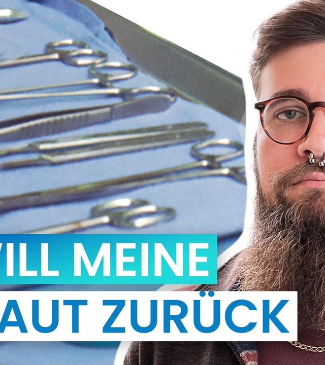 Beschneidung: Nur ein Stück Haut? I reporter