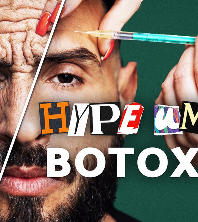 BOTOX: Neues BARE MINIMUM? -- HYPECULTURE