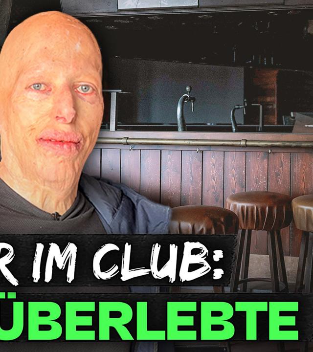 Brandkatastrophe im Club: Wie er verletzt überlebt