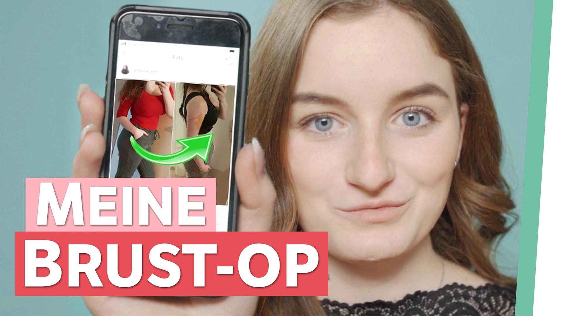 Brustverkleinerung: Mein letzter Ausweg! - Auf Klo