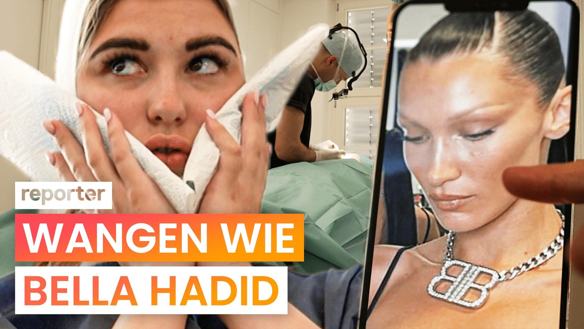Buccal Fat Removal: Folgen egal? Alles fürs perfekte Gesicht - reporter