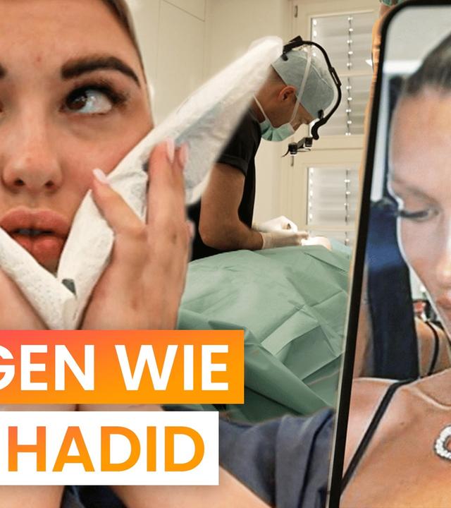 Buccal Fat Removal: Folgen egal? Alles fürs perfekte Gesicht - reporter