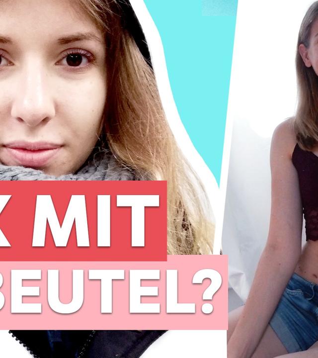 Darmkrankheit Colitis Ulcerosa: Ich kacke anders