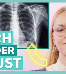 DGS - Trichterbrust: Meine Brust wuchs nach innen - Auf Klo