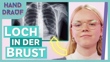DGS - Trichterbrust: Meine Brust wuchs nach innen - Auf Klo