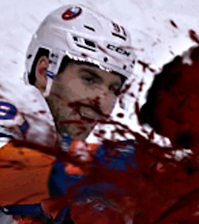 EISHOCKEY endet BLUTIG!