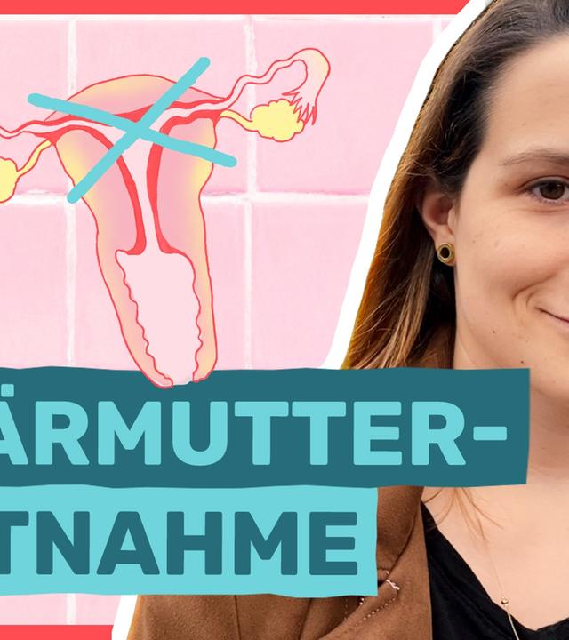 Gebärmutter entfernt: Darum hab ich es gemacht!