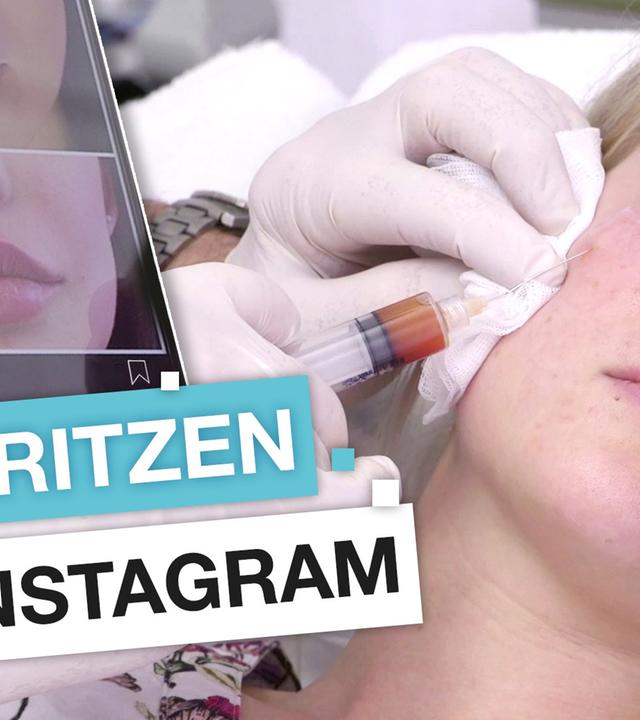 Gefährliche Werbung: Schönheits-OP für das perfekte Selfie?