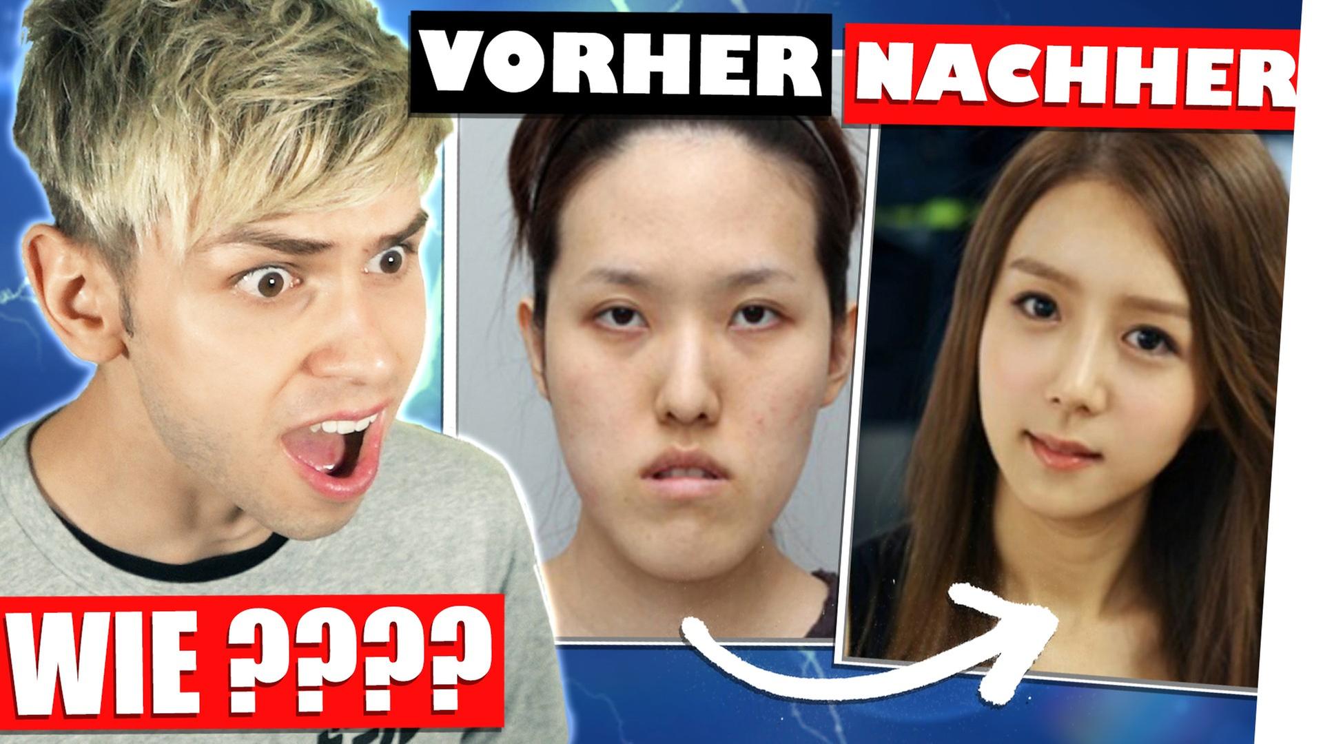 ICH RASTE AUS! Reaktion auf koreanische Schönheits-Ops! ZU KRASS! - Kostas Kind