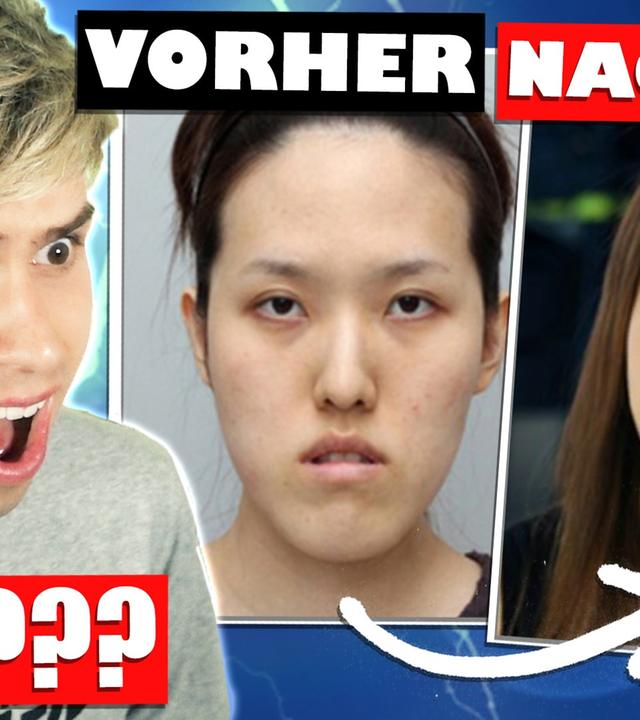 ICH RASTE AUS! Reaktion auf koreanische Schönheits-Ops! ZU KRASS! - Kostas Kind
