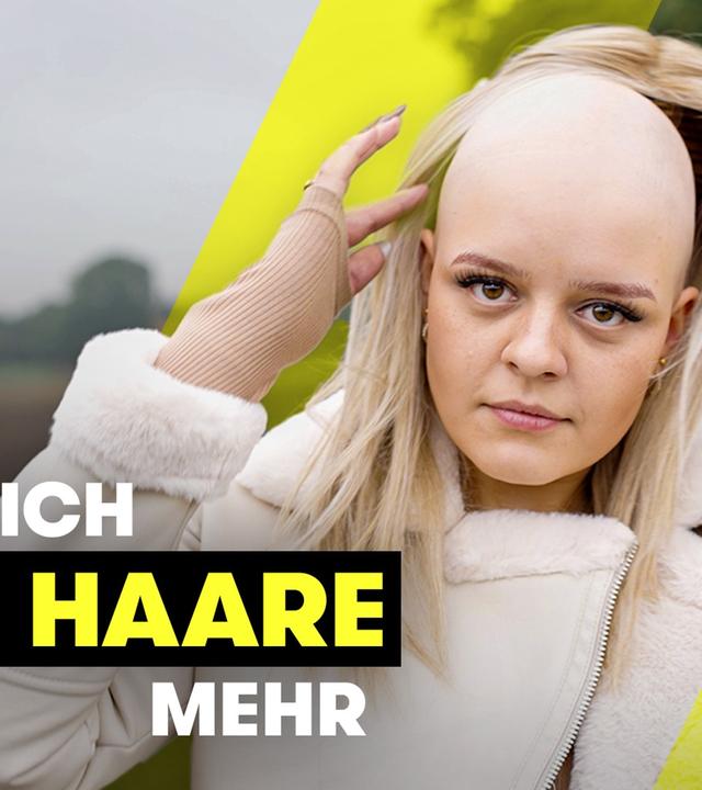 Im Urlaub: Leonie (22) verliert fast alle Haare - TRU DOKU