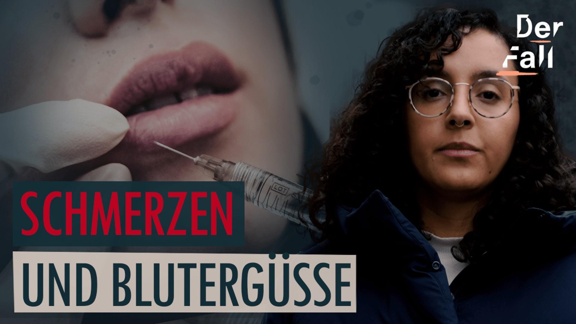 Influencerin spritzt illegal Hyaluronsäure - Der Fall Duygu Ö.