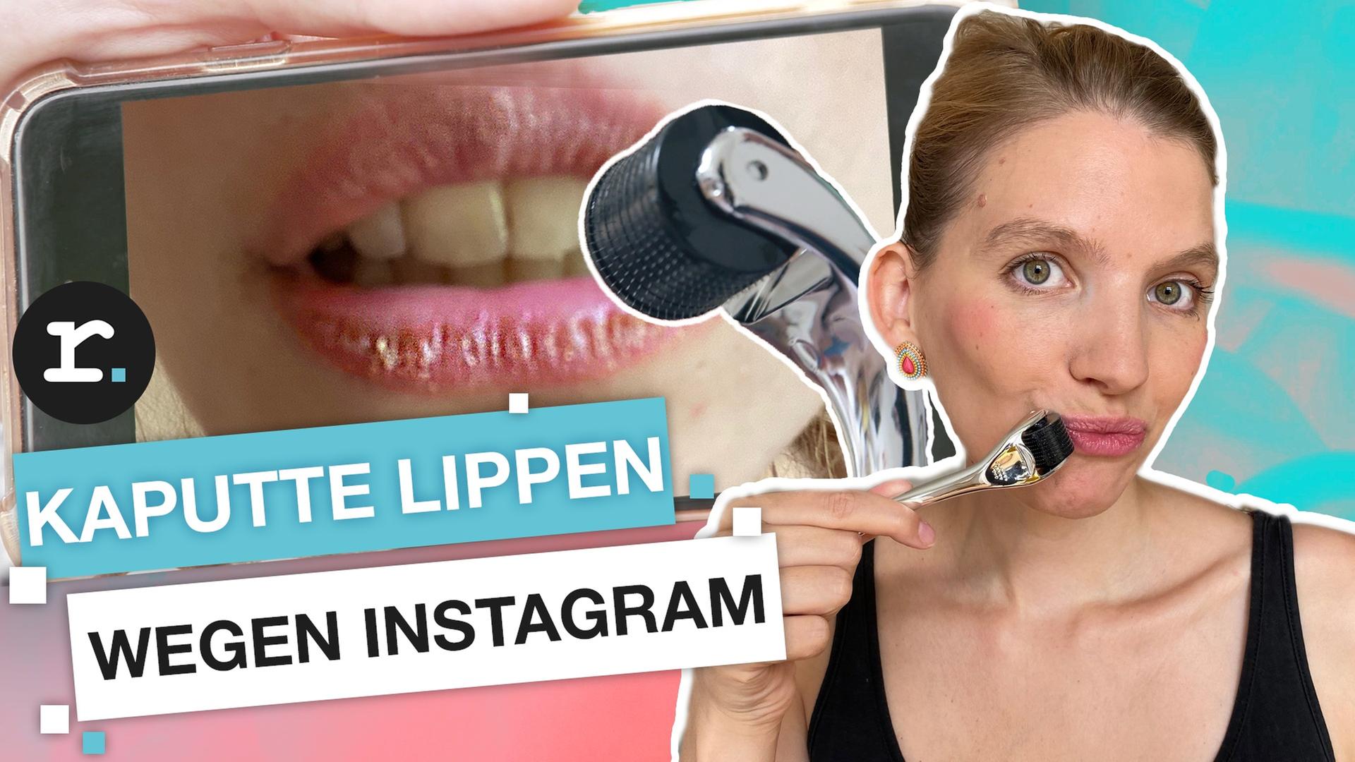Instagram Trend: So gefährlich ist der Beauty Hype Lip Roller I reporter
