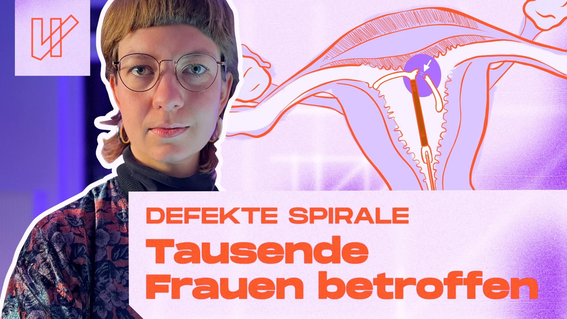 Kaputte Spirale: Frauen wurden 2 Jahre nicht informiert