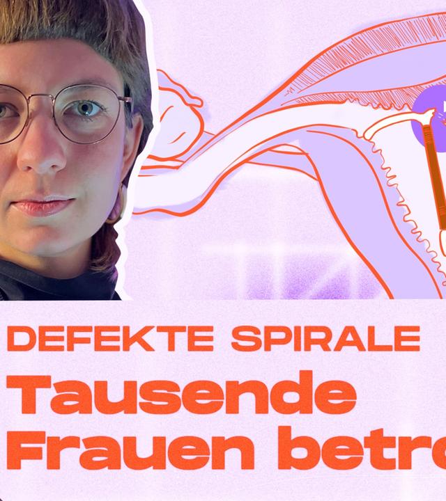 Kaputte Spirale: Frauen wurden 2 Jahre nicht informiert