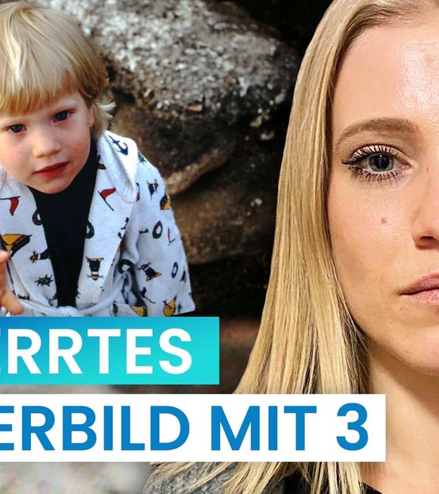 Körperschemastörung: Ich sehe & spüre Fett, das nicht da ist I reporter