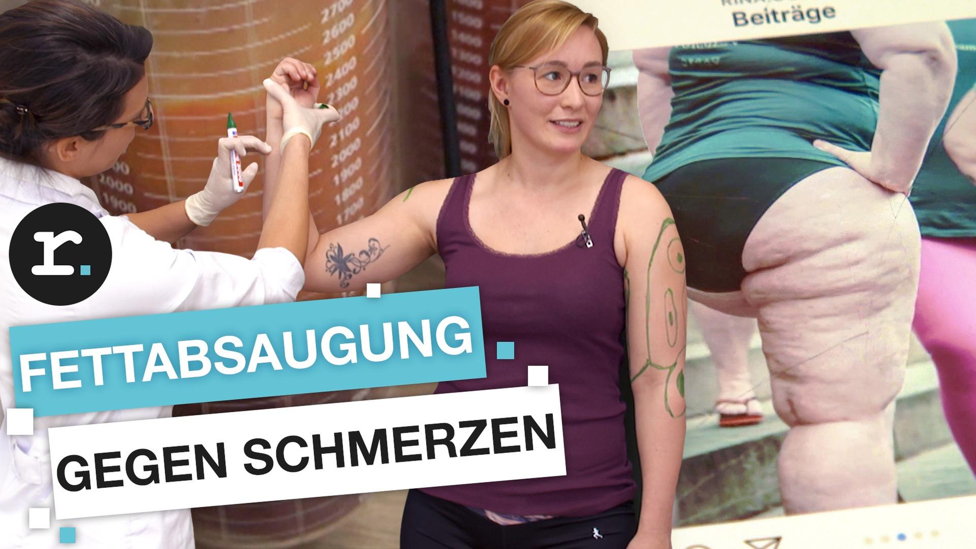 Lipödem: Horror-Krankheit, aber Krankenkasse zahlt nicht - reporter