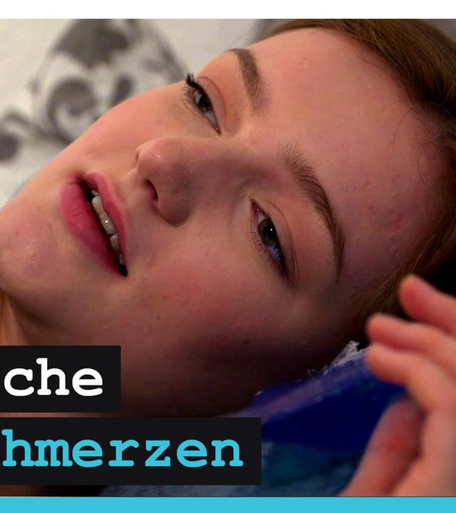 Migräne: So sehr leide ich unter der Krankheit