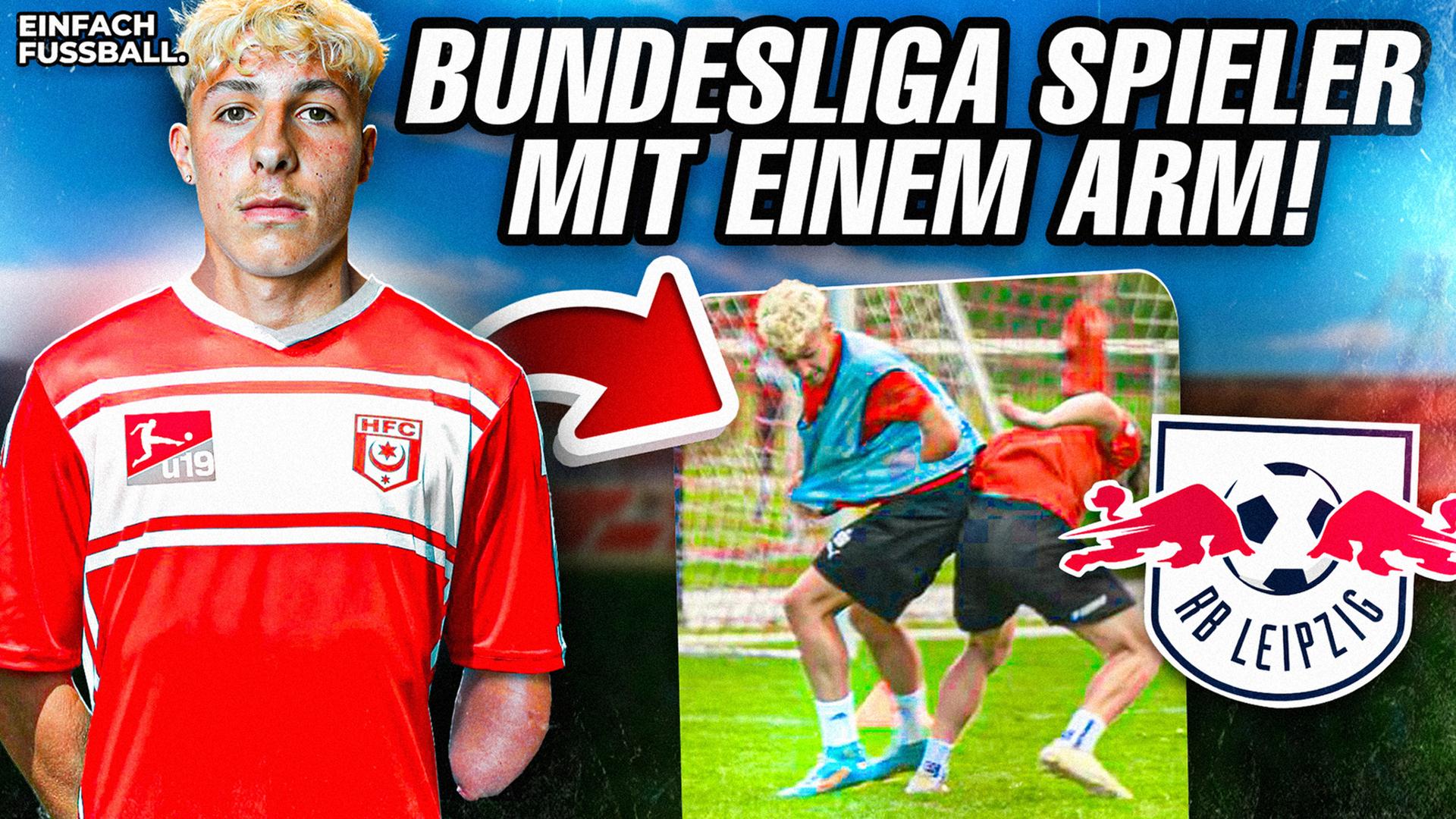 Mit einem Arm zum Bundesliga Profi? 