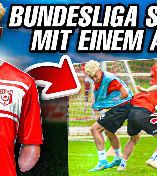 Mit einem Arm zum Bundesliga Profi? 