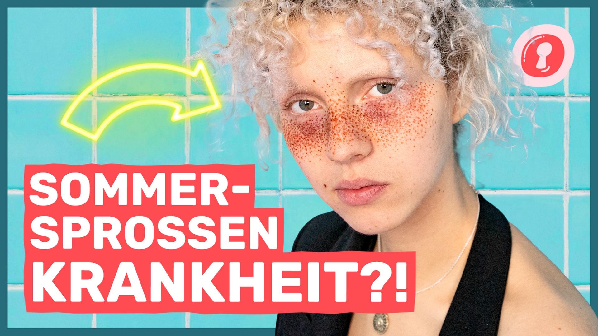 Mobbing, weil ich ANDERS aussehe! - AUF KLO