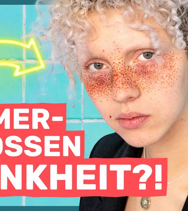 Mobbing, weil ich ANDERS aussehe! - AUF KLO