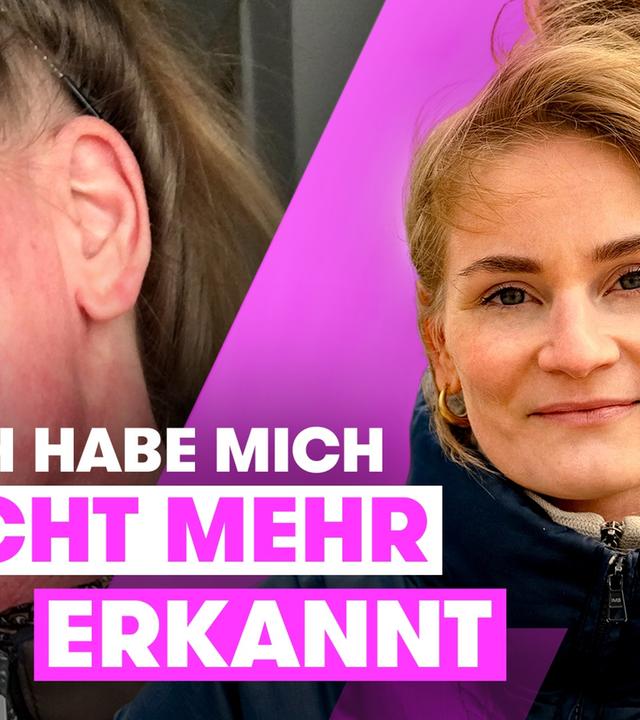 Neurodermitis-Hölle: Nora kann heute wieder in den Spiegel schauen I TRU DOKU