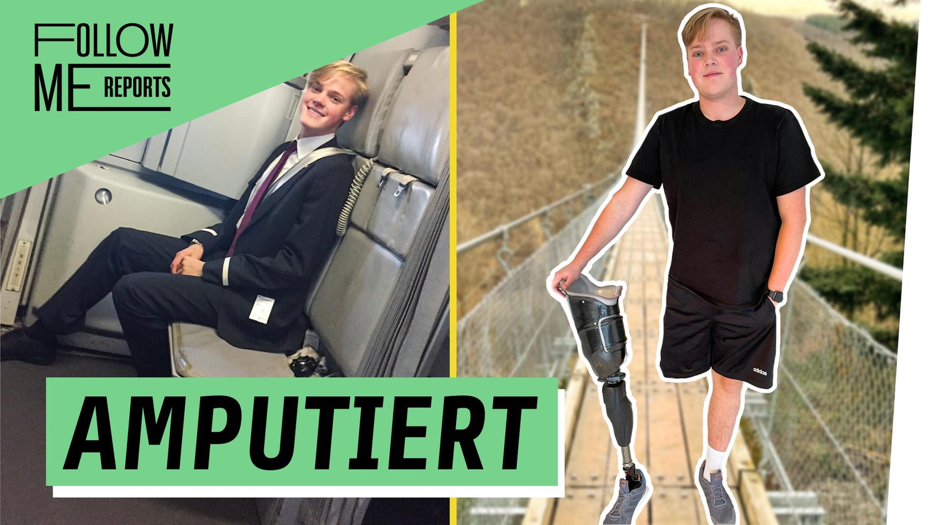 Nur noch ein Bein – Alex kämpft für seinen Traum!