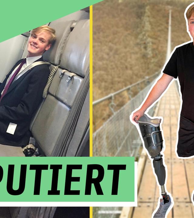 Nur noch ein Bein – Alex kämpft für seinen Traum!
